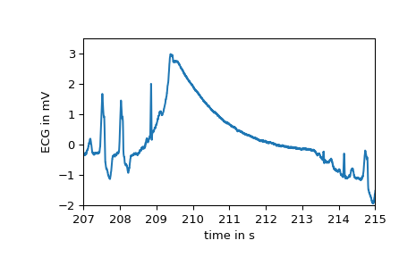 ../../_images/scipy-misc-electrocardiogram-1_02_00.png